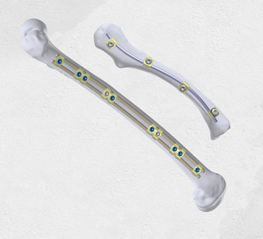Spinal implants